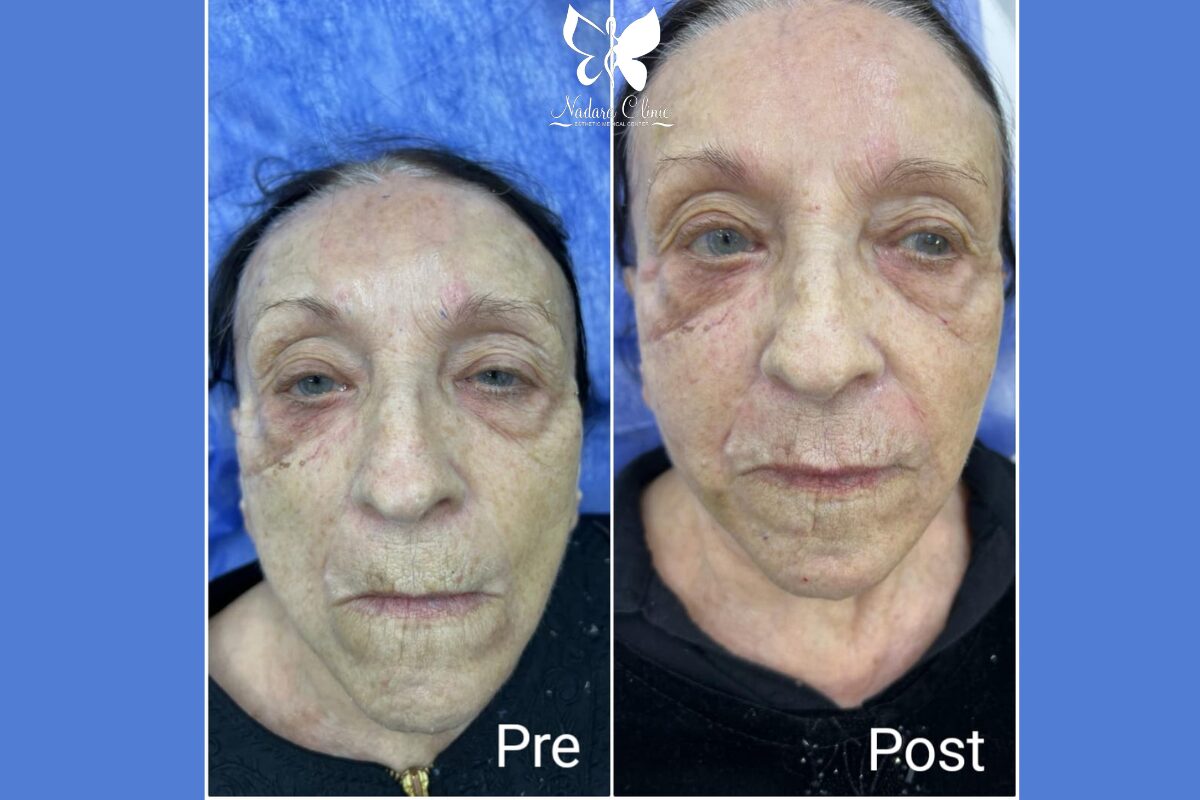 مركز حقن فيلر في الغردقة